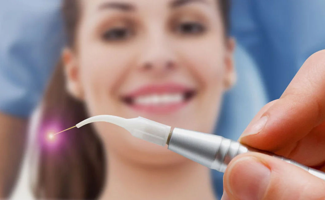 Lazer ile Diş Tedaivisi